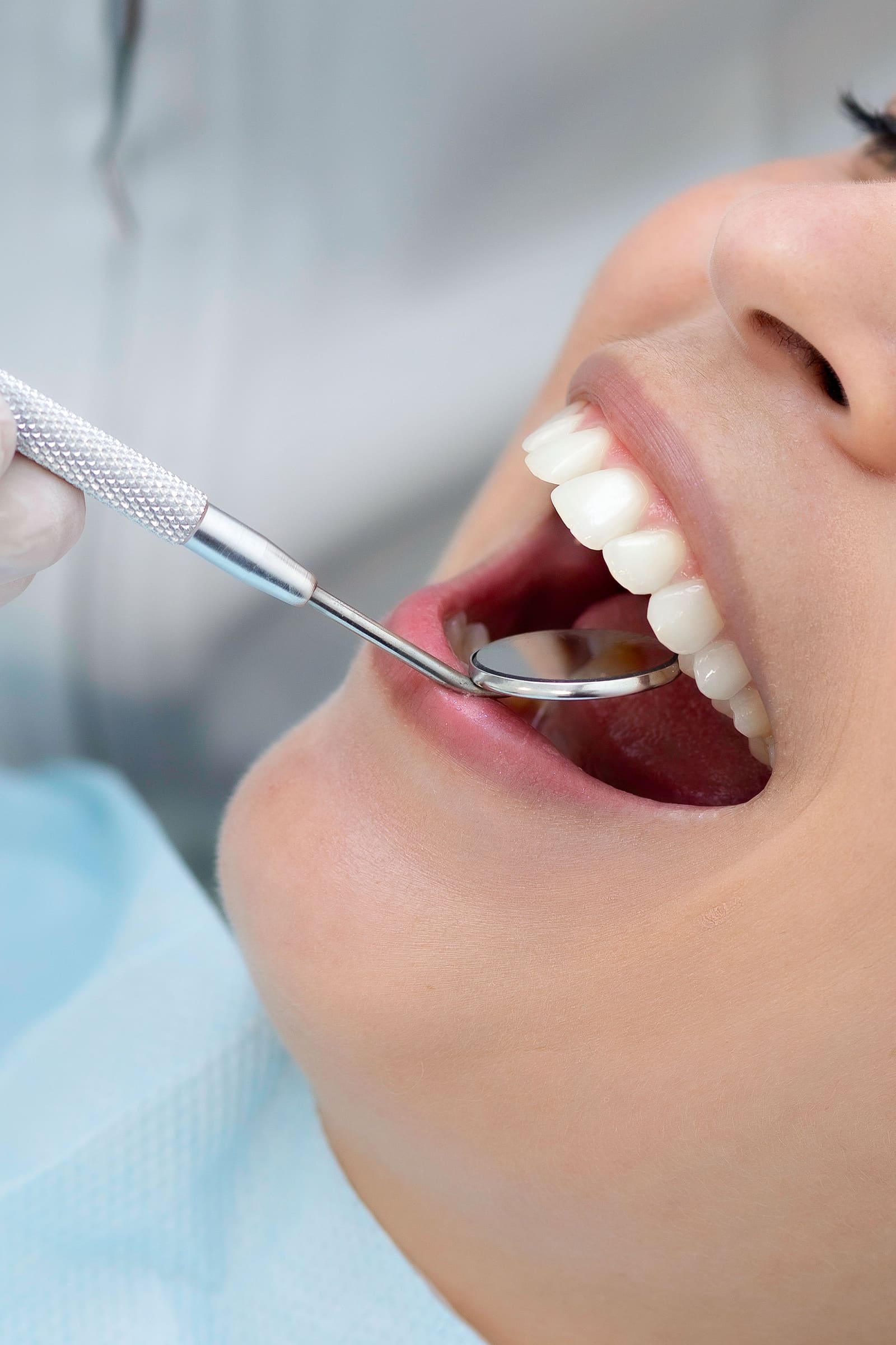 Exame odontológico de rotina sendo realizado com espelho clínico