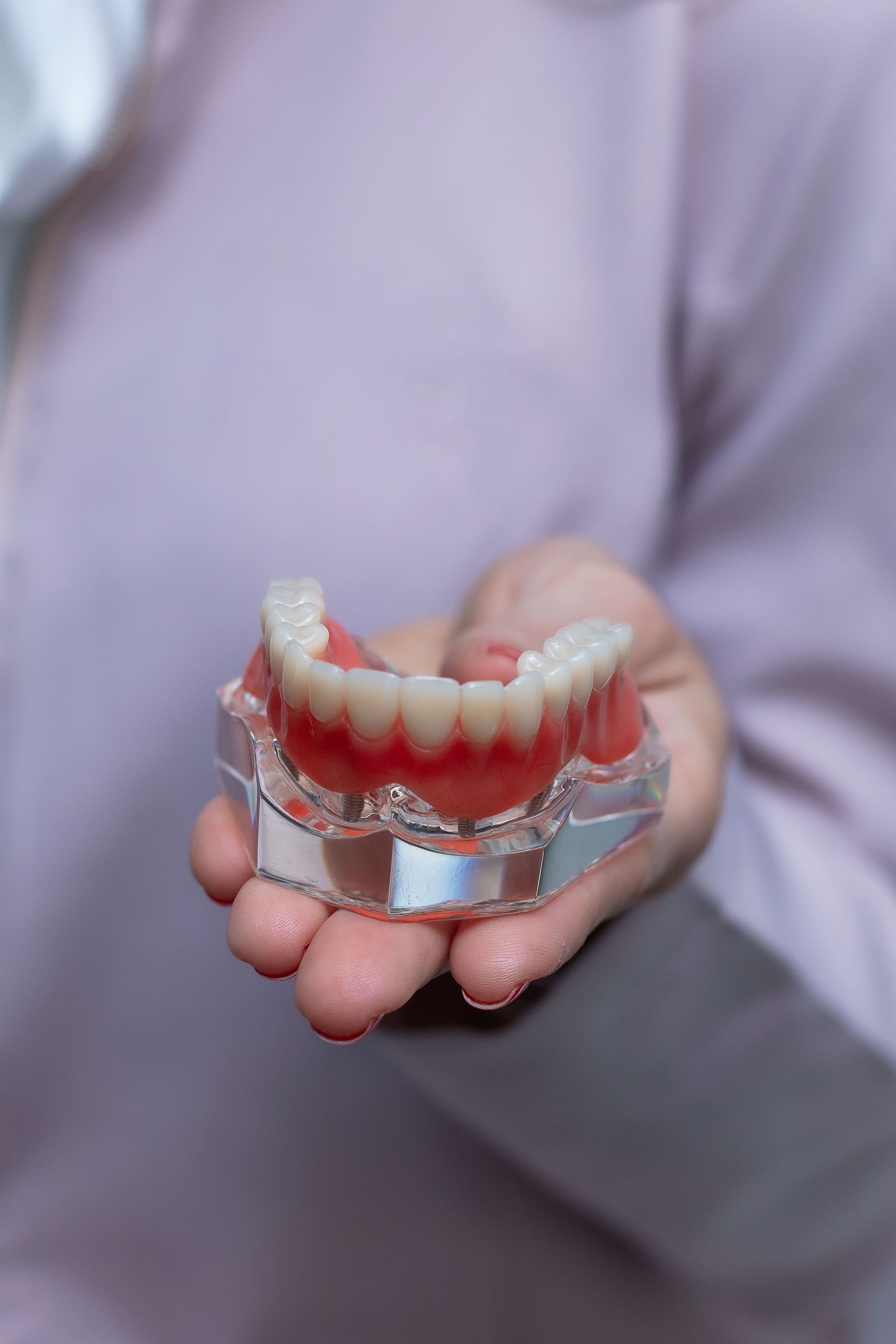 Modelo de prótese dentária sobre implantes apresentado na mão de uma profissional